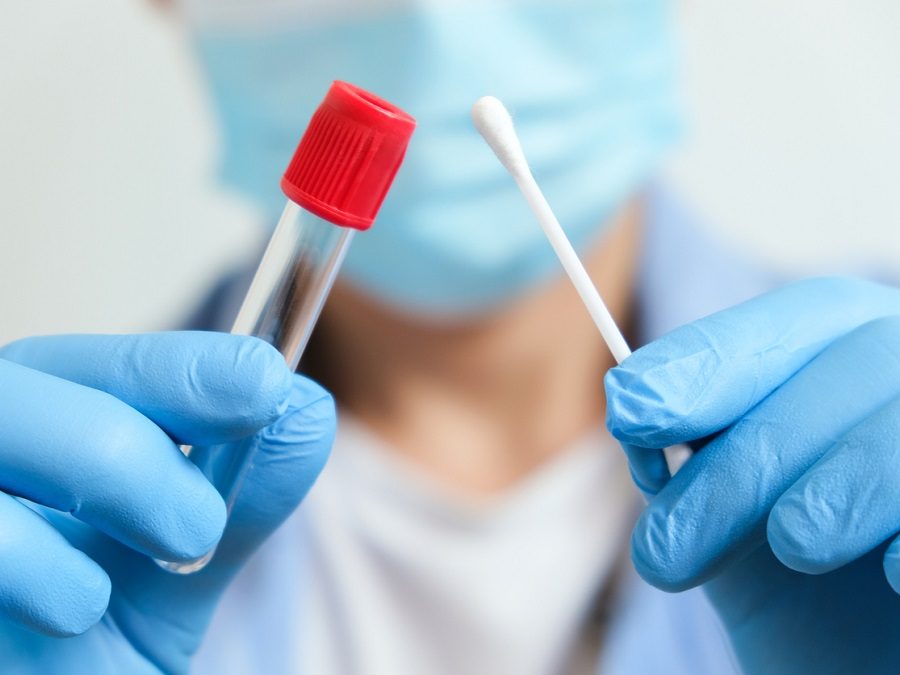 Doctor holds a COVID-19 swab collection, wears blue gloves and a PPE protective mask, and carries a test tube to collect the OP NP and  test coronavirus.